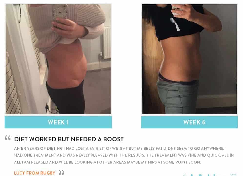 Before and After Dieting Chesterfield