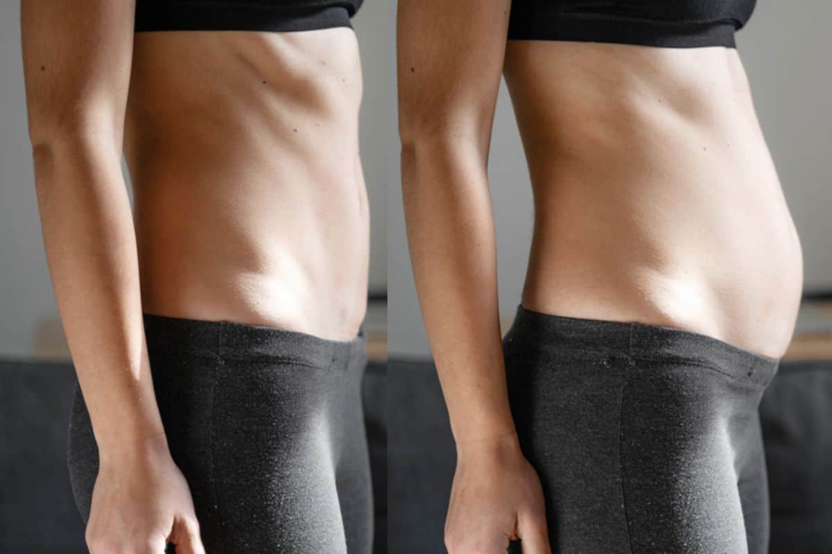 How long does diastasis recti take to improve Chesterfield?