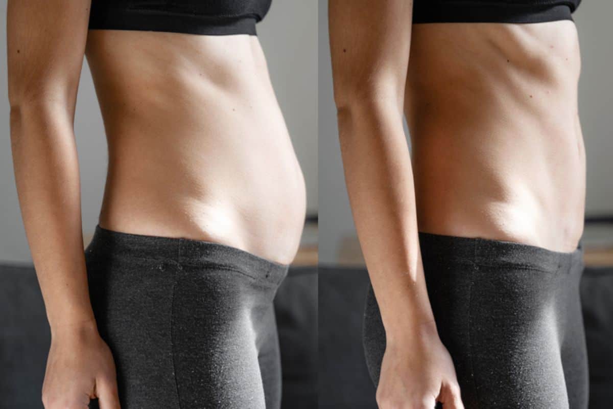 Post-Pregnancy: What Happens to Your Abdominal Muscles After Birth Chesterfield