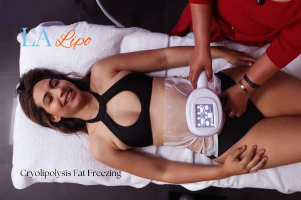 woman getting cryolipolysis Chesterfield