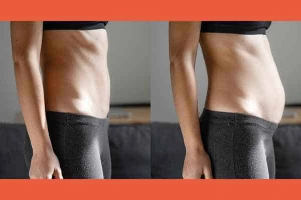 LA-EMS Body Sculpting results Chesterfield