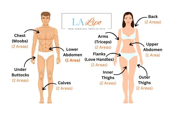 LA LIPO Cryolipolysis Areas Chesterfield