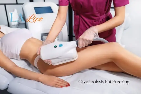 Woman receiving coolsculpting Chesterfield treatment on her thighs