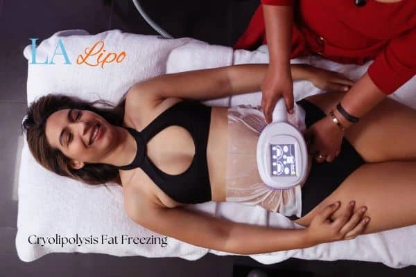 woman getting cryolipolysis Chesterfield