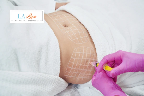 aqualyx fat dissolving injections Chesterfield